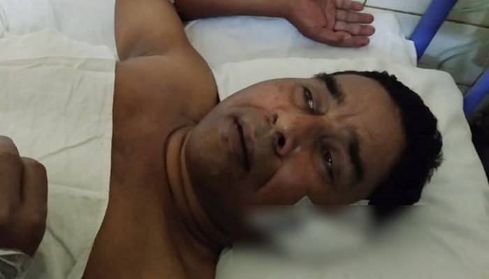 সড়ক দুর্ঘটনায় ইমরুল কায়েসের বাবা আহত