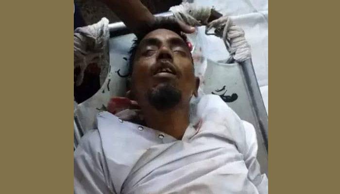 ওসির সঙ্গে দেখা করে ফেরার পথে ২ পায়ের রগ কাটল প্রতিপক্ষ