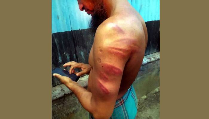 স্ত্রীর মৌখিক অভিযোগে শিক্ষককে বেধড়ক পেটালেন চেয়ারম্যান