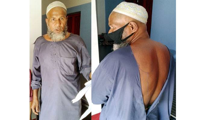 চাল আনতে গিয়ে মারধরের শিকার রিকশাচালক