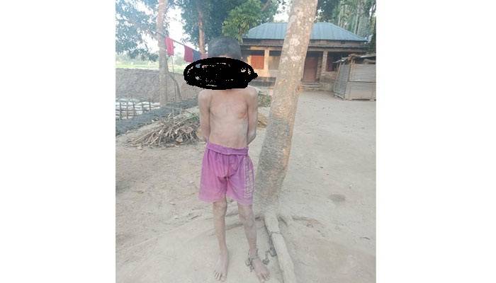 বগুড়ায় শিকলে বাঁধা এক শিশুর জীবন