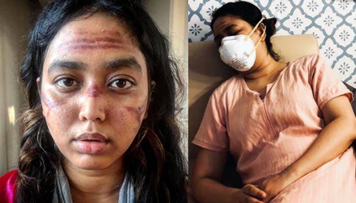 মাস্ক পরে অভিনেত্রী ভাবনার একি হাল!