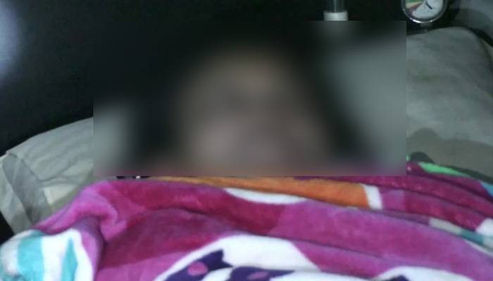 স্বামীকে তালাক দেওয়ায় অ্যাসিডে পুড়তে হলো নুপুরকে
