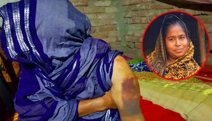 ‘জিন তাড়াতে’ ৭০ বছরের বৃদ্ধাকে মারপিট