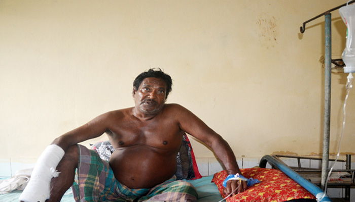 বাবার হাত ভেঙে দিল মাদকাসক্ত ছেলে