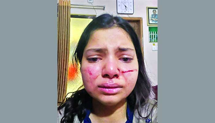 'বিয়ের এক সপ্তাহের মাথায় গায়ে হাত তোলে স্বামী-শাশুড়ি'