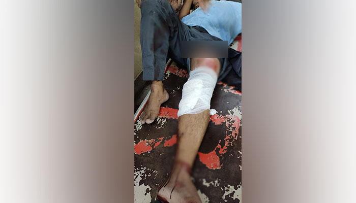 বাস থেকে শিক্ষককে ধাক্কা, চাকার নিচে পা