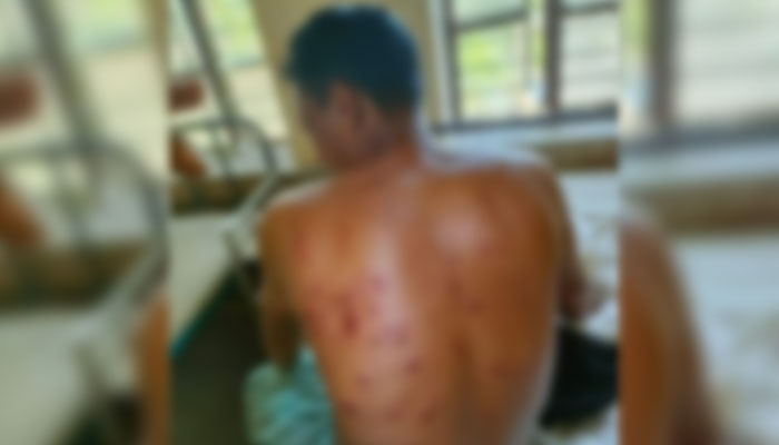 কুষ্টিয়ায় শটগানের গুলিতে আওয়ামী লীগ নেতা নিহত