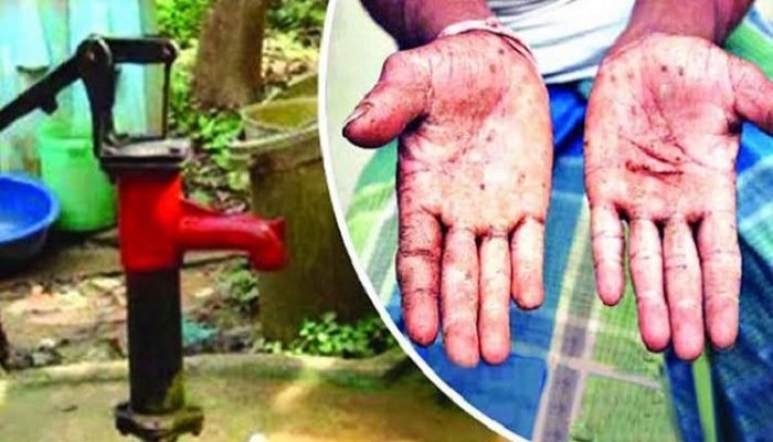 দৃষ্টির বাইরে আর্সেনিক বিষ