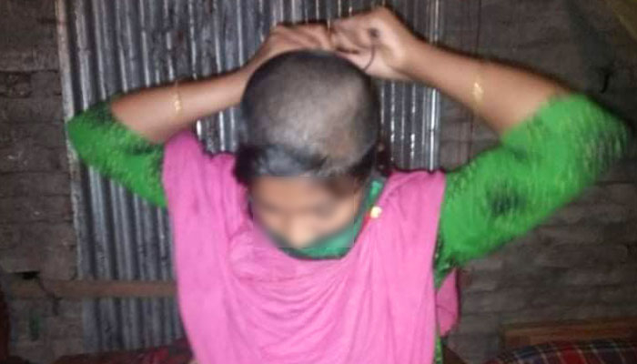 যৌতুক না পেয়ে স্ত্রীকে ন্যাড়া করল মাদকাসক্ত স্বামী