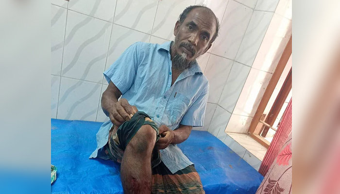 হঠাৎ শিয়ালের আক্রমণে একে একে আহত ২৩