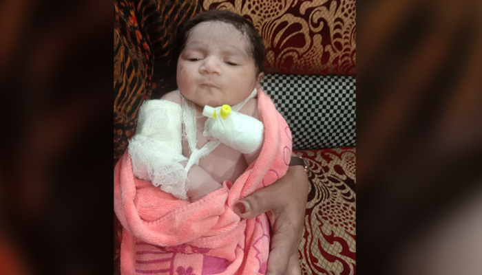 নতুন ঠিকানা পেল মায়ের পেট ফেটে ভূমিষ্ঠ নবজাতক নতুন ঠিকানা পেল মায়ের পেট ফেটে ভূমিষ্ঠ নবজাতক