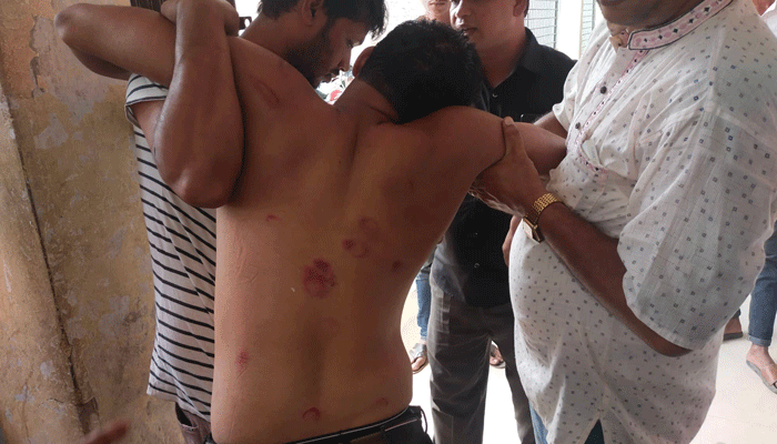 সোনাগাজীতে ব্যবসা প্রতিষ্ঠানে ঢুকে যুবলীগ নেতাকে হাতুড়িপেটা সোনাগাজীতে ব্যবসা প্রতিষ্ঠানে ঢুকে যুবলীগ নেতাকে হাতুড়িপেটা