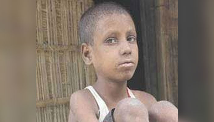 বাড়ি ফিরল বৃক্ষশিশু রিপন