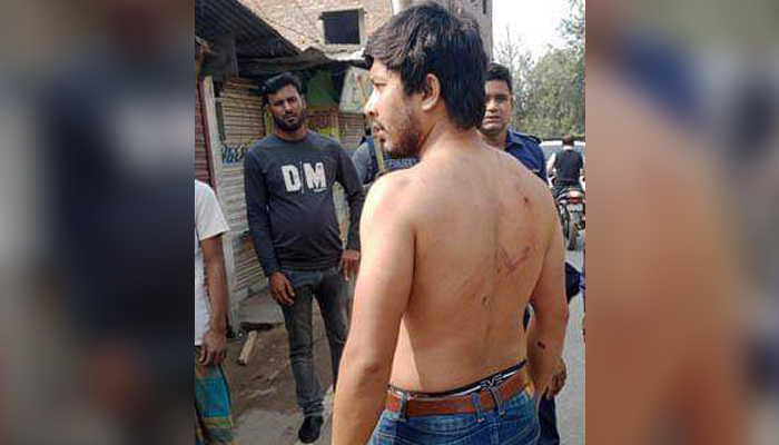 'টিটকারি' করা নিয়ে দুই গ্রামবাসীর সংঘর্ষ, আহত ১০ 'টিটকারি' করা নিয়ে দুই গ্রামবাসীর সংঘর্ষ, আহত ১০