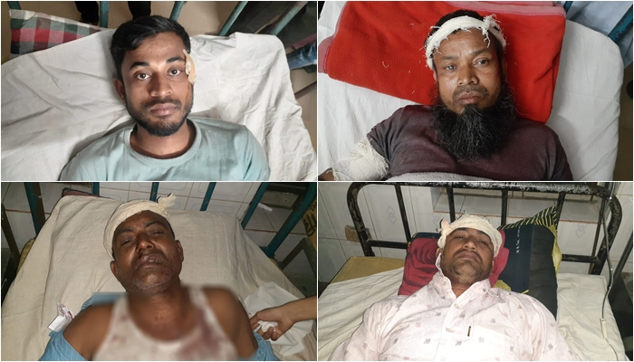 ‘ইভটিজিংয়ের প্রতিবাদ’ করায় সংঘর্ষ, আহত ১০