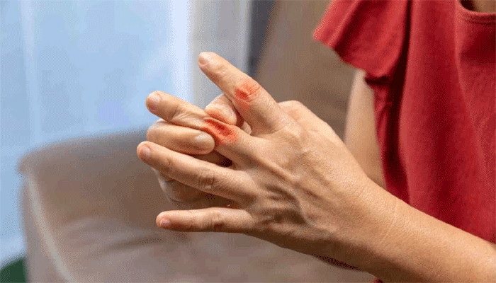 ইউরিক অ্যাসিডের মাত্রা নিয়ন্ত্রণ কেন জরুরি?