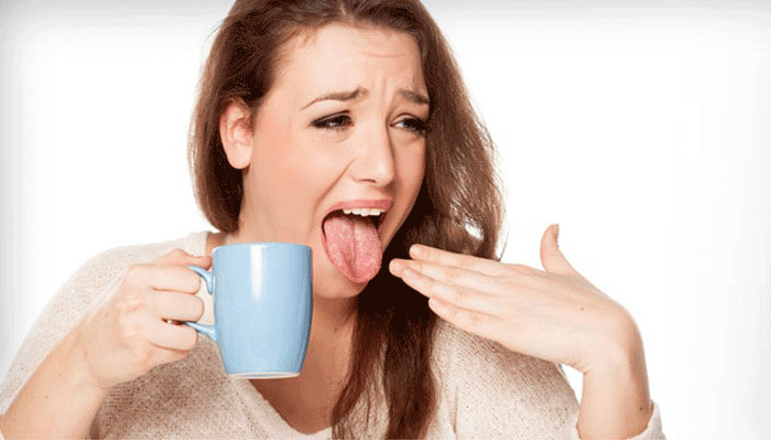 গরম খেতে গিয়ে জিহ্বা পুড়েছে? কী করবেন