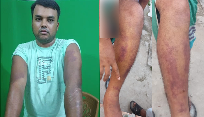 শরীয়তপুরে সেই পুলিশ কর্মকর্তাদের বিষয়ে তদন্ত প্রতিবেদন দেওয়ার নির্দেশ