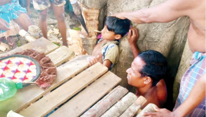 চার ঘণ্টার চেষ্টায় রক্ষা পেল শিশুটির হাত চার ঘণ্টার চেষ্টায় রক্ষা পেল শিশুটির হাত