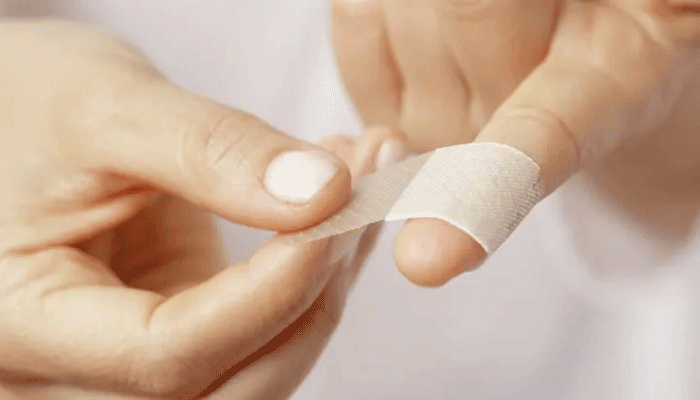হঠাৎ কেটে গেলে যা করবেন