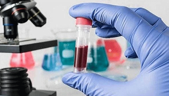 ডোপ টেস্টে ভোগান্তি চালকদের