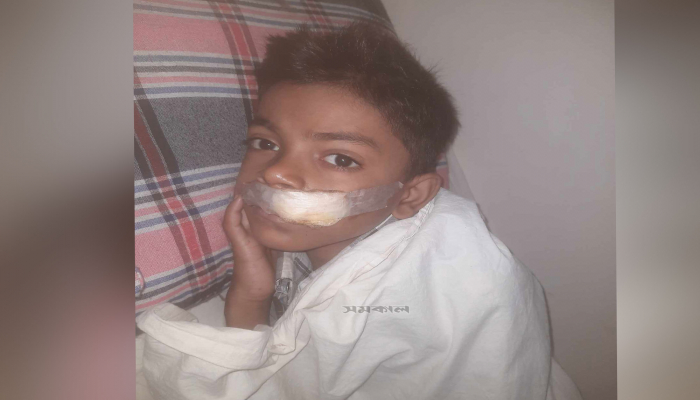 ট্রেন দুর্ঘটনায় ভীত রবিন বলতে পারছে না নিজের পরিচয়